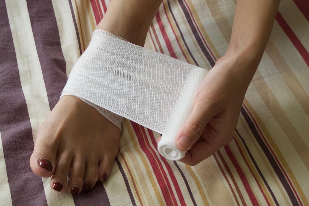 povreda, stopalo, Foto: Shutterstock