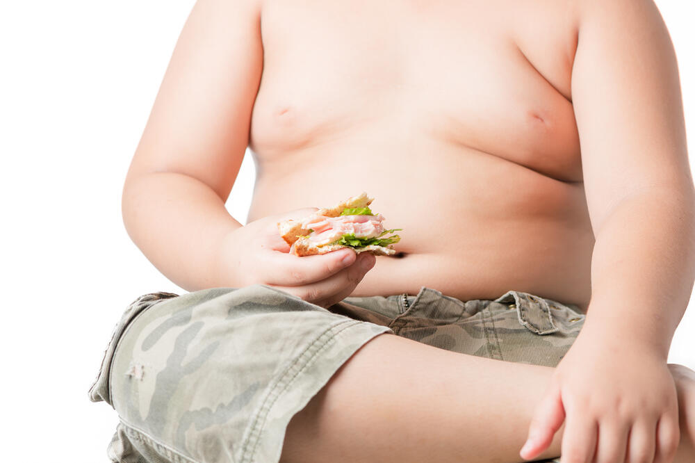gojaznost, debljina, Foto: Shutterstock