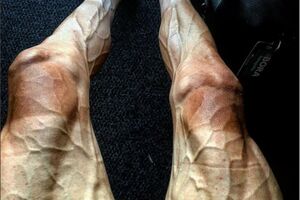 Kako noge izgledaju nakon 16 etapa Tur de Fransa