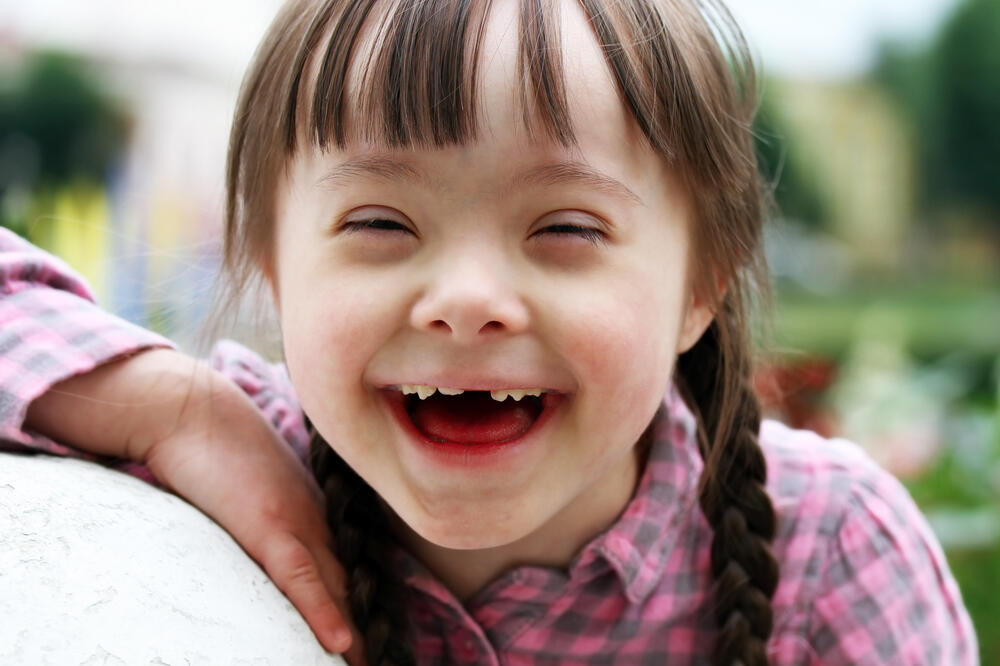 Daunov sindrom, Foto: Shutterstock