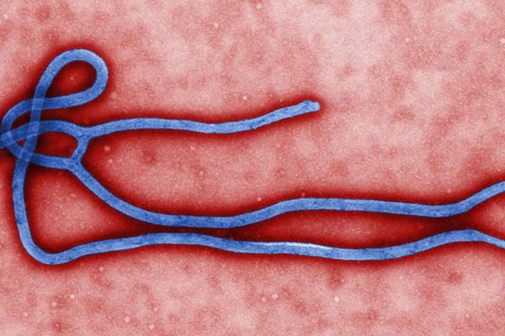 Virus Ebole, Foto: Wikipedia