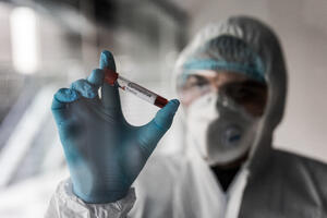 Srbija: Još dvoje umrlo od koronavirusa, pozitivno još 82