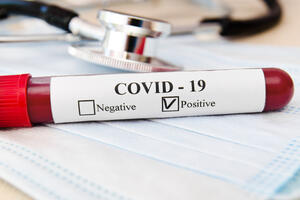 Preminula jedna osoba, 87 novih slučajeva koronavirusa