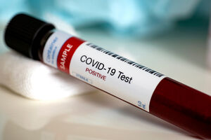 IJZCG: 53 nova slučaja koronavirusa, najviše u Podgorici