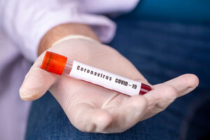 Još 57 novih slučajeva koronavirusa