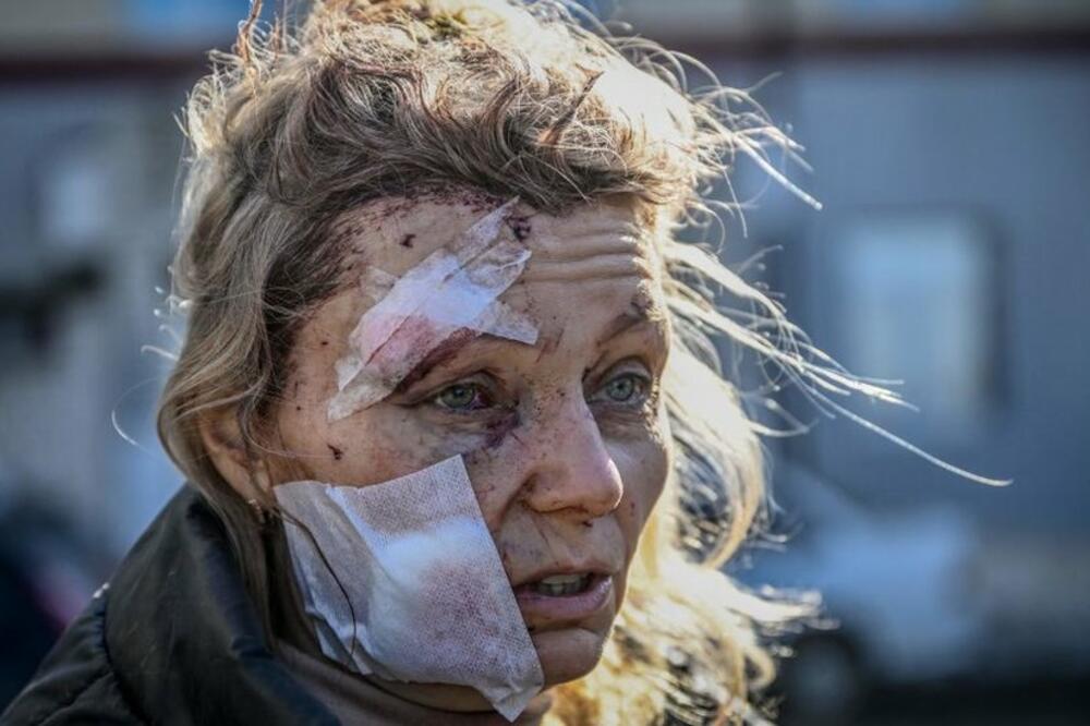 Žena koja je povrijeđena u ruskom granatiranju postala je predmet teorija zavjere i lažnih tvrdnji na internetu, Foto: Getty Images