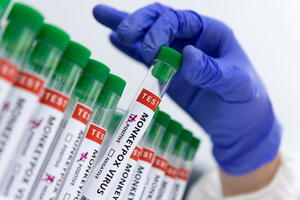 SAD hoće da vakcinišu kontakte osoba oboljelih od majmunskih...