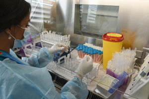Bez preminulih, 91 novi slučaj koronavirusa