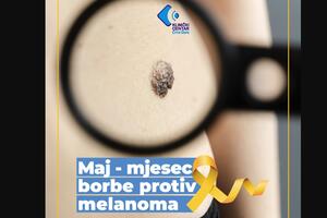 KCCG: Mjesec borbe protiv melanoma kože - preventivni pregledi bez...