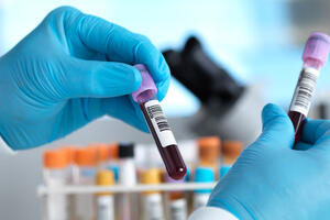 Velika Britanija: Test krvi za 50 vrsta kancera ohrabrio naučnike