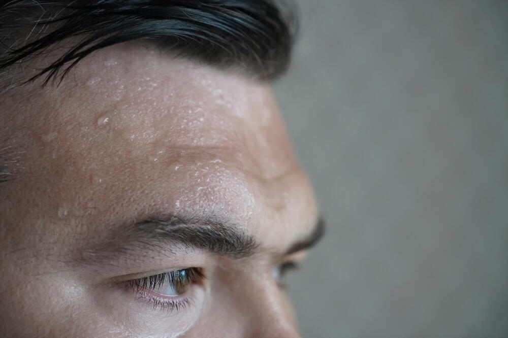 Znojenje štiti organizam, ali može biti i znak za uzbunu (ilustracija), Foto: Shutterstock