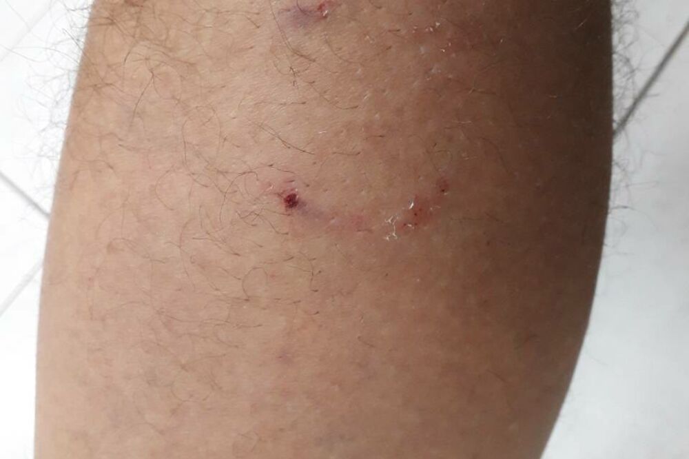 ujed psa, Podgorica, Foto: Privatna arhiva