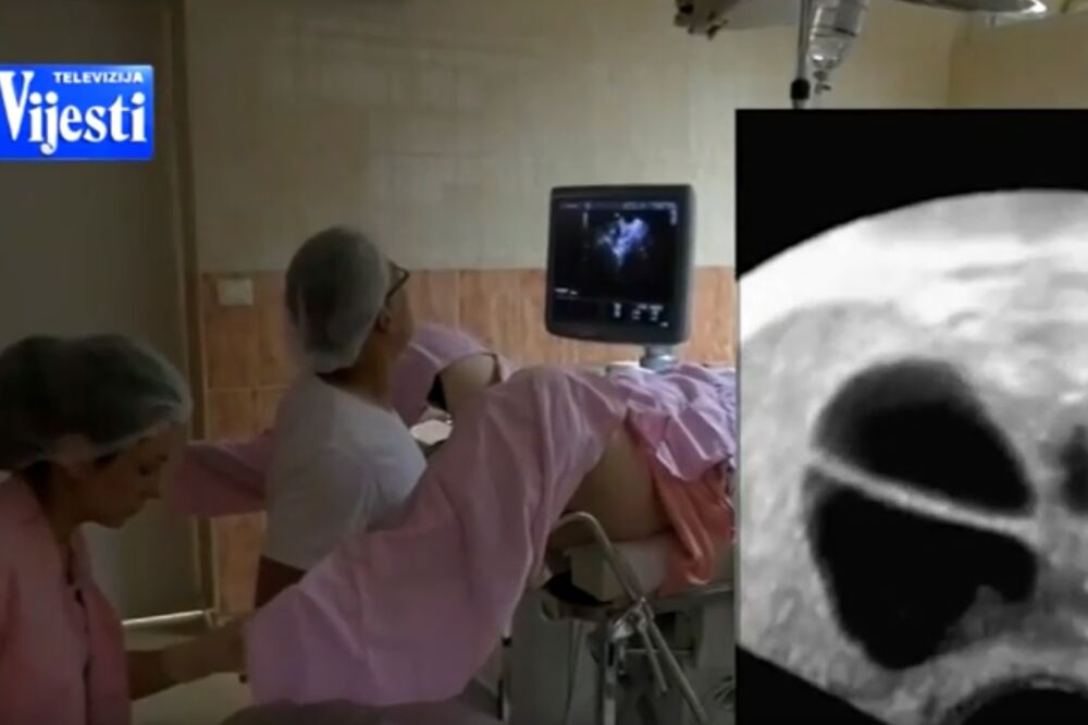 ginekolog, Foto: Screenshot (YouTube)