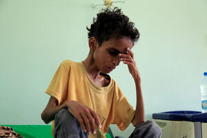 UZNEMIRUJUĆE Sva težina stradanja civila u ratu u Jemenu
