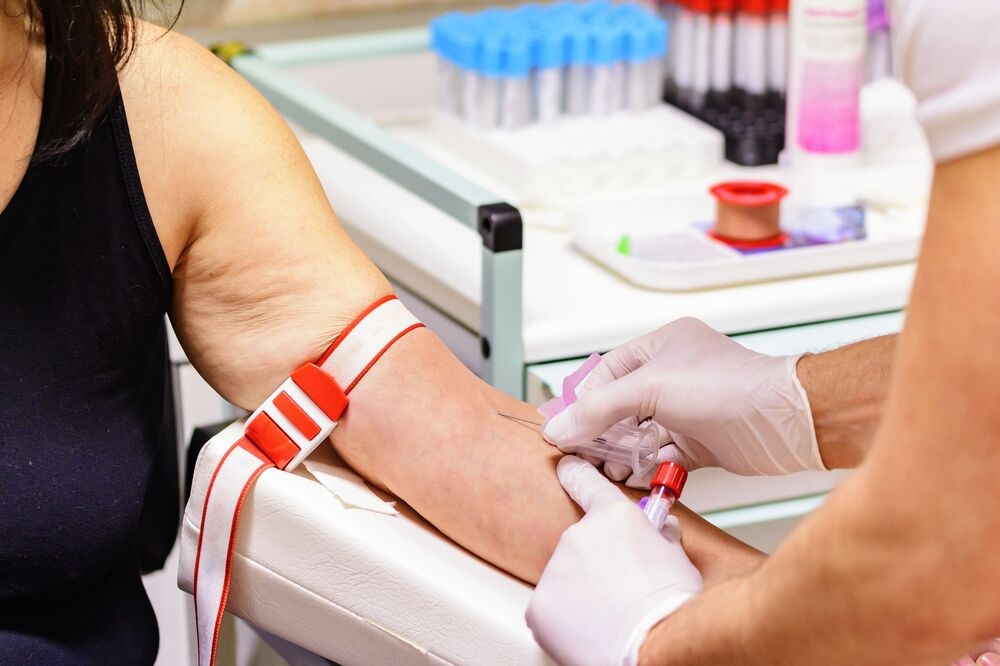 Vađenje krvi, Foto: Shutterstock