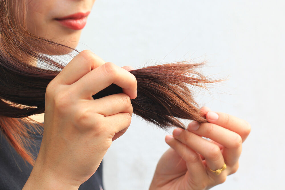 Oštećena kosa jedan je od simptoma, Foto: Shutterstock