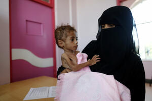 85 hiljada djece mlađe od pet godina umrlo od gladi u Jemenu