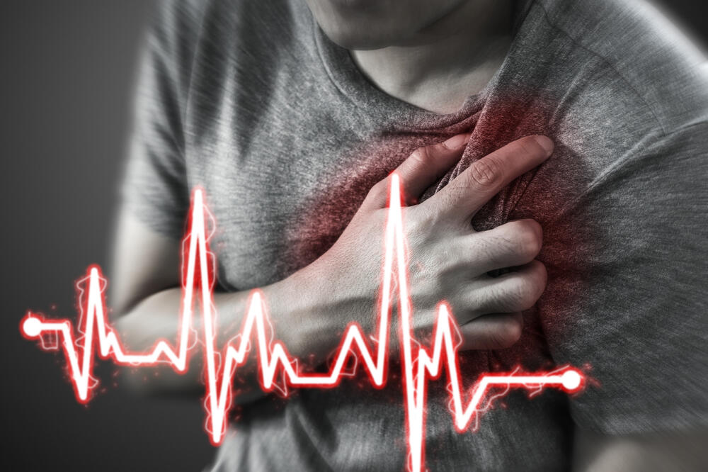 srčani udar, Foto: Shutterstock, Shutterstock
