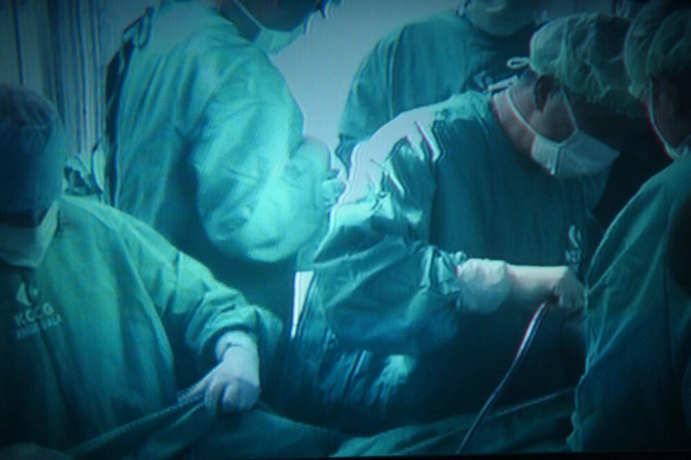hirurzi, Foto: Arhiva Vijesti