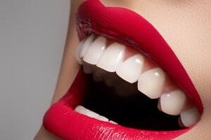 Četiri načina na koje ćete kod kuće izbijeliti zube