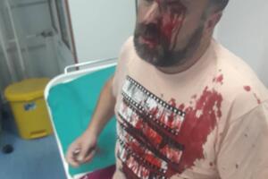 U Beloj Crkvi pretučen novinar Stefan Cvetković, osumnjičeni...