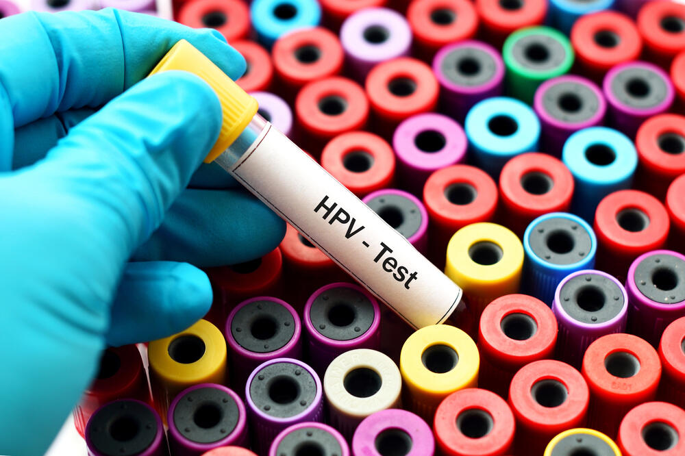 HPV, Foto: Shutterstock