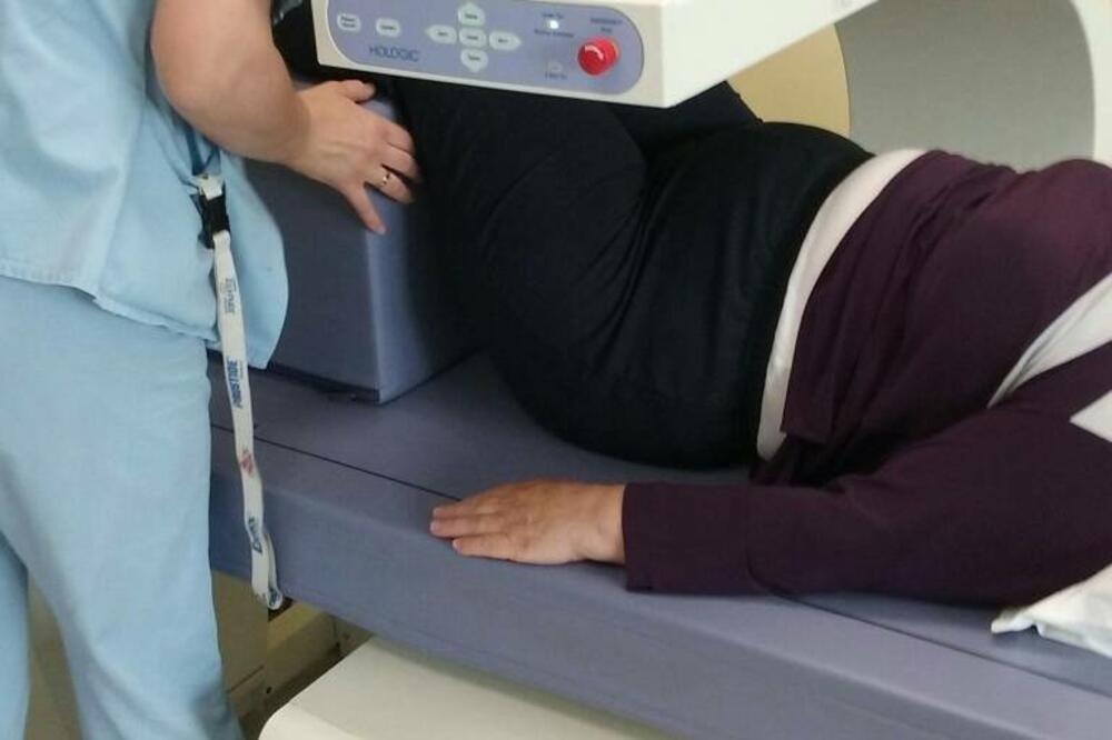 osteoporoza, Foto: Privatna arhiva