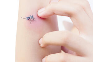 Kako da se zaštitimo od komaraca?