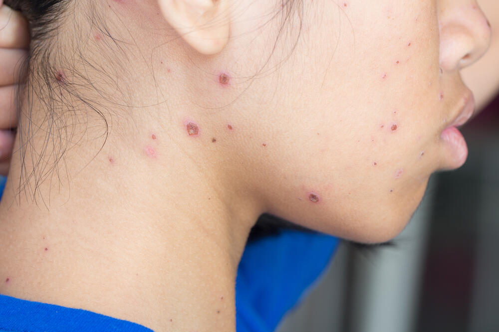 male boginje, Foto: Shutterstock.com