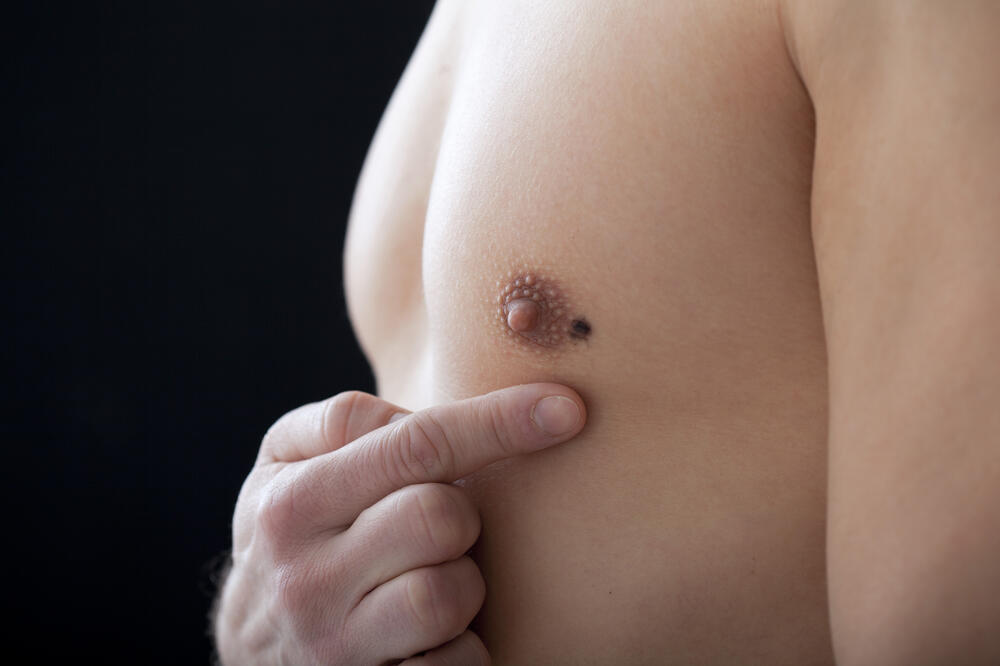 rak dojke, muškarac, Foto: Shutterstock