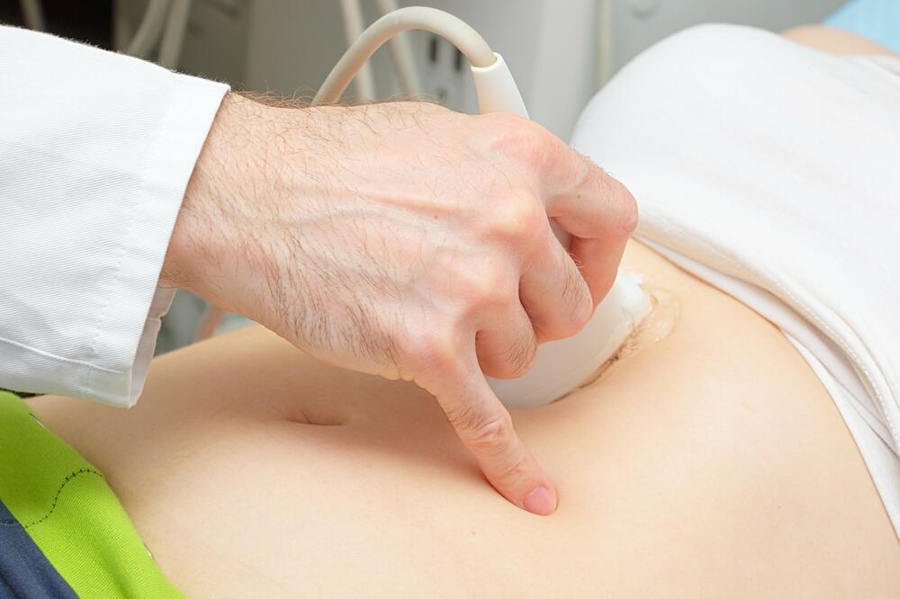 kamen u žuči, Foto: Shutterstock