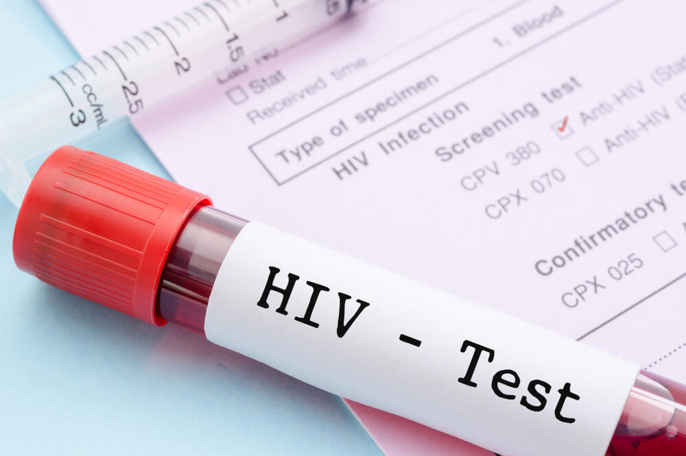 HIV test, Foto: Shutterstock