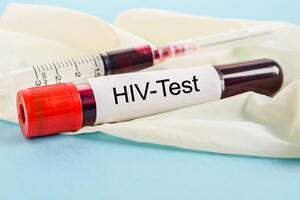 Ministarstvo zdravlja: Registrovano 20 novih slučajeva HIV-a