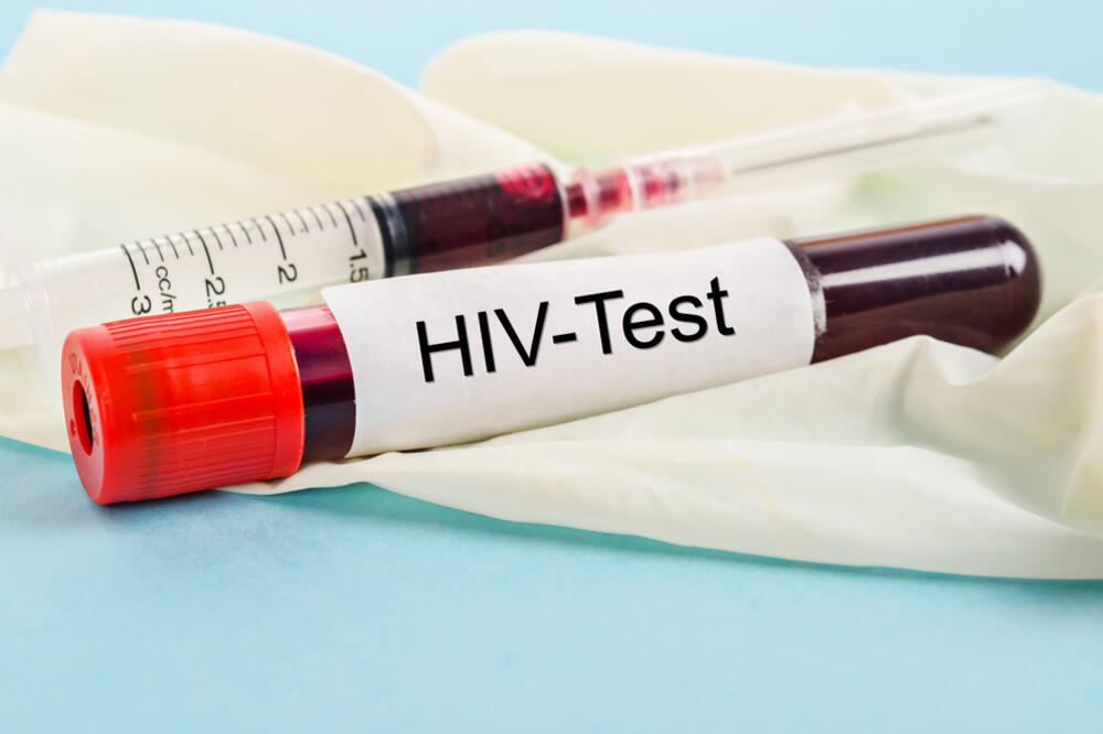 HIV AIDS, Foto: Shutterstock