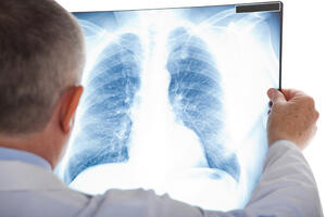 Kako da pročistite pluća za samo tri dana
