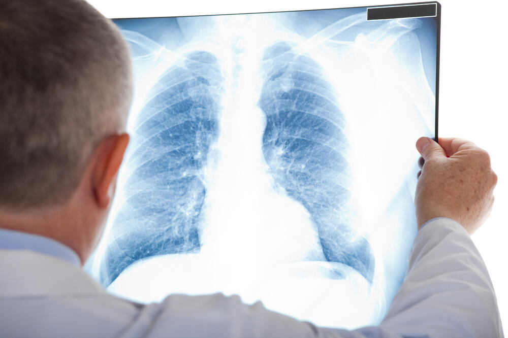pluća, Foto: Shutterstock