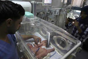U Gazi rođene spojene bliznakinje