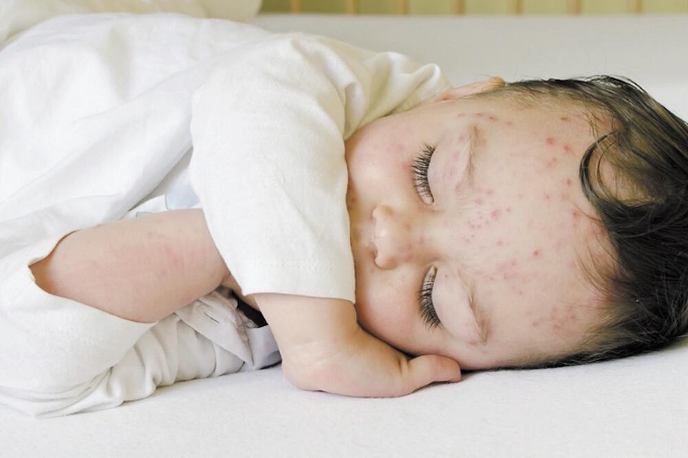 boginje, Foto: Shutterstock.com