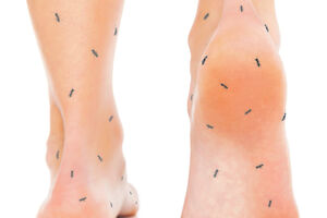 Boje jutra: Trnjenje nogu i ruku - kada se radi o ozbiljnom...