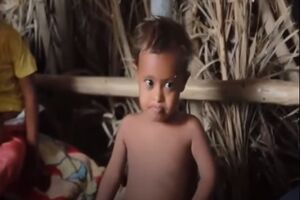 Saleem je umirao od gladi, a danas je jak i nasmijan dječak