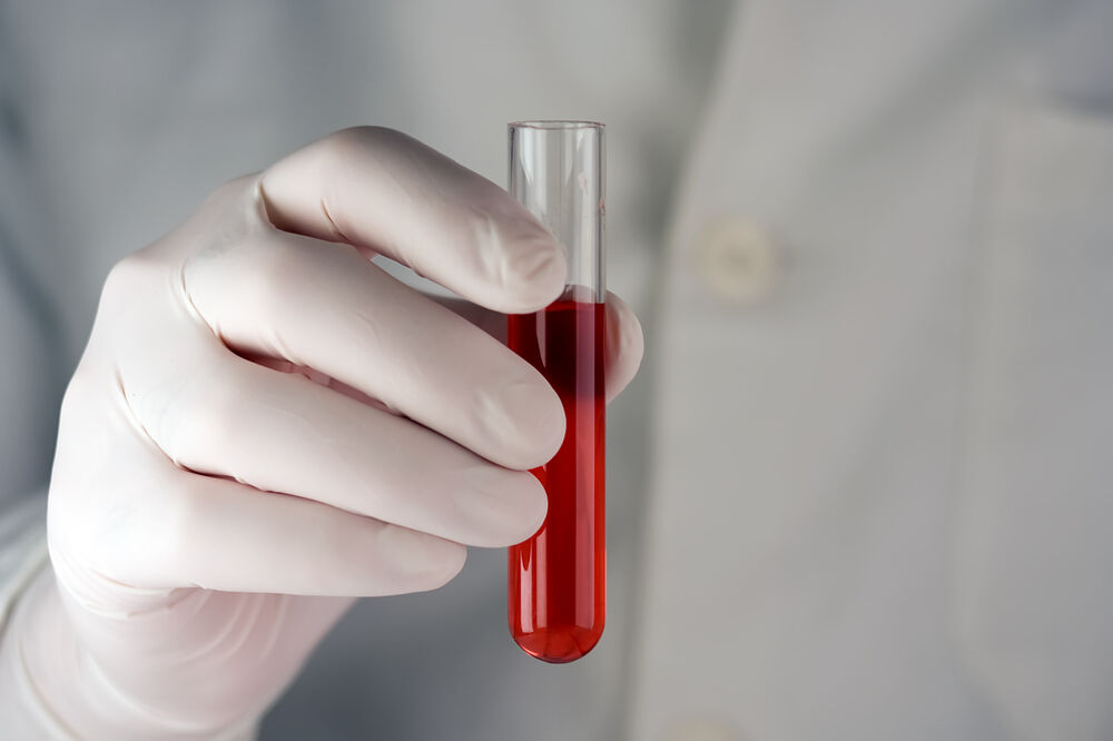 krv, laboratorija, Foto: Shutterstock