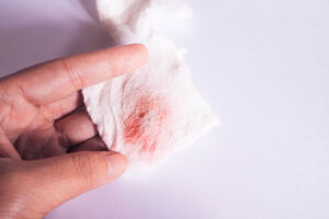 Zašto dermatolozi ne vole maramice za skidanje šminke?