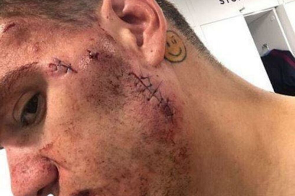 ederson, Foto: Printscreen