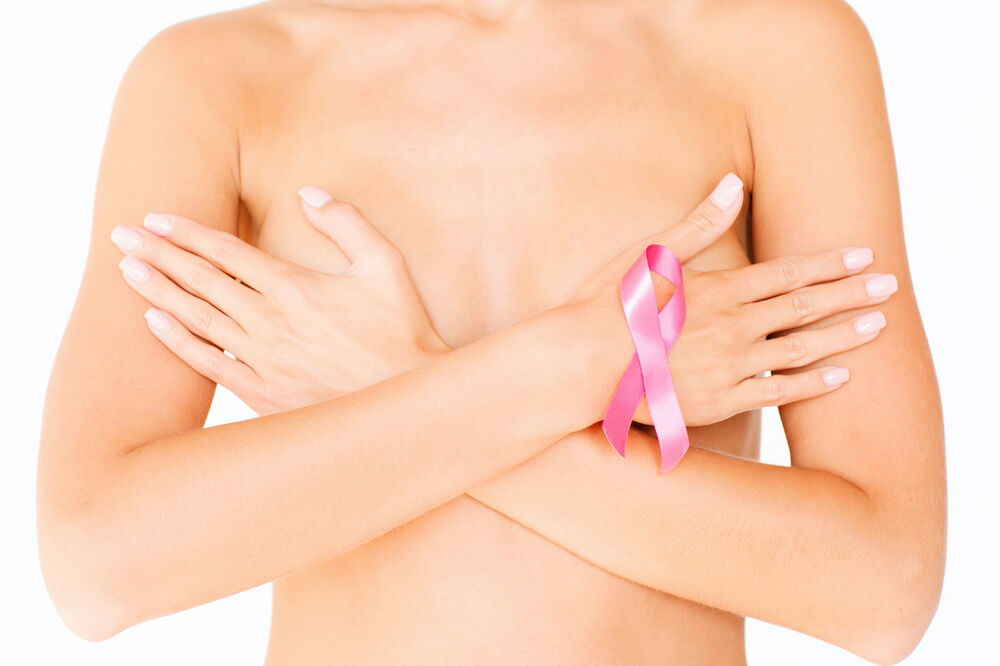 rak dojke, Foto: Shutterstock