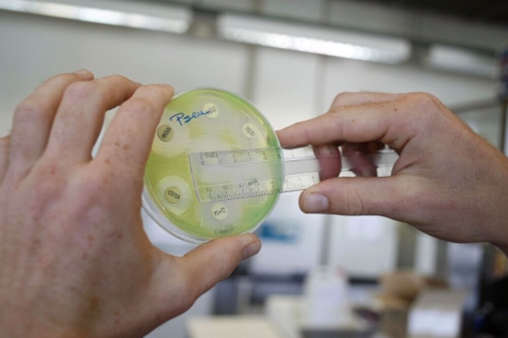 bakterija, Foto: AFP