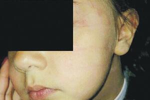 Ćeraniću za šamar učenici prijeti zatvor