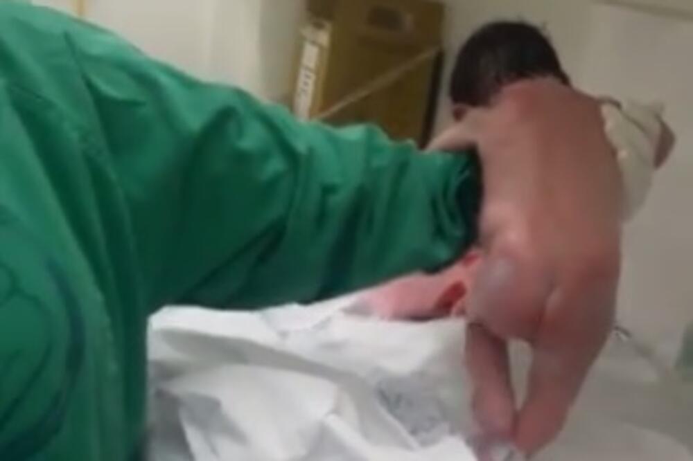 beba Brazil, Foto: Printscreen