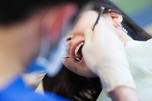 Zubar joj izvadio 22 zdrava zuba i naplatio 15.000 dolara