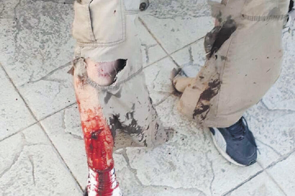 Ujed psa, Foto: Čitalac Vijesti