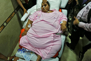 Egipćanka zahvaljujući operaciji izgubila 325 kilograma, liječenje...